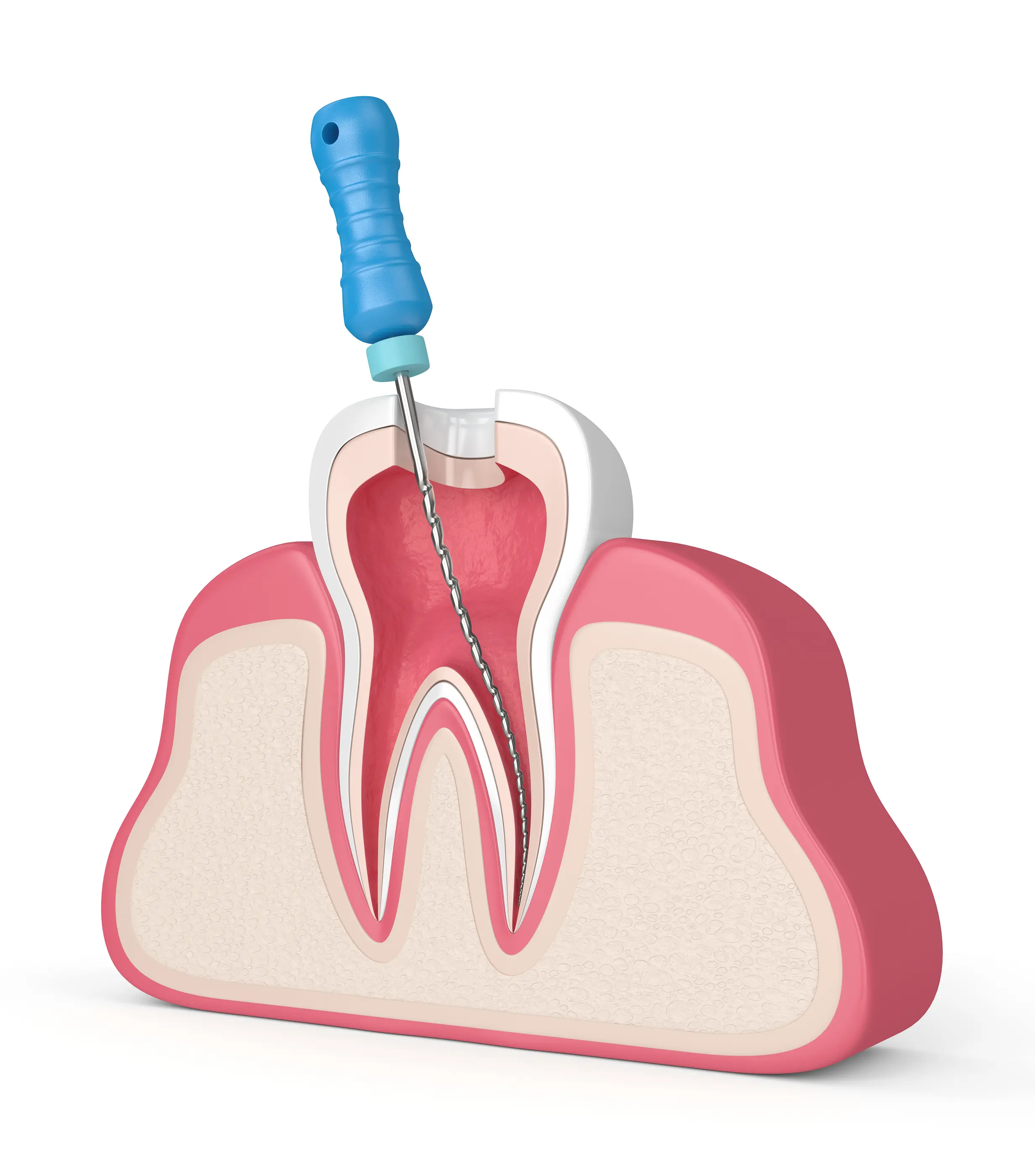 root canal briarcliff manor ny
