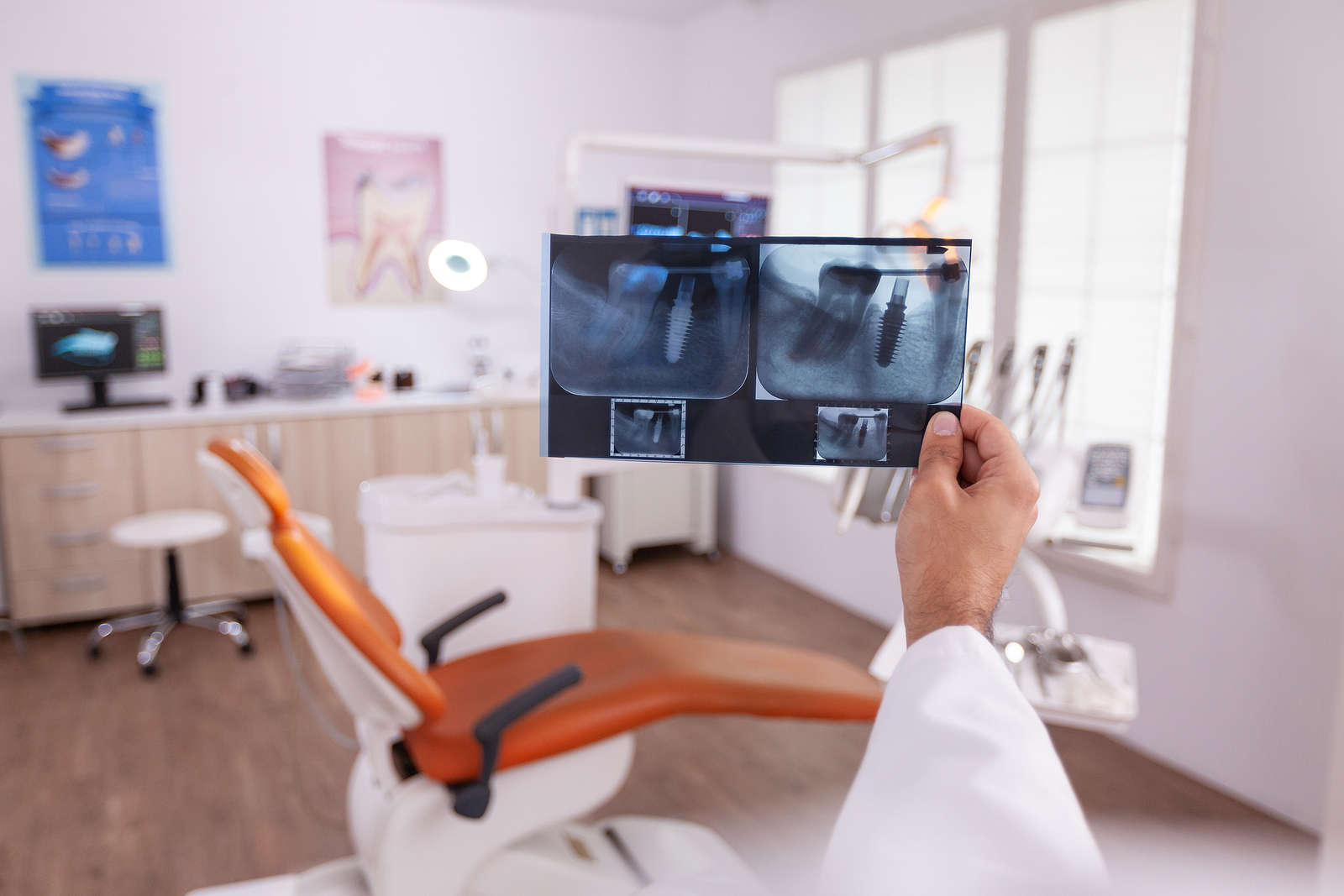 is-oral-surgery-considered-major-surgery-greenberg-oral-surgery