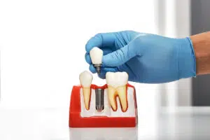 Dental implants in Westchester