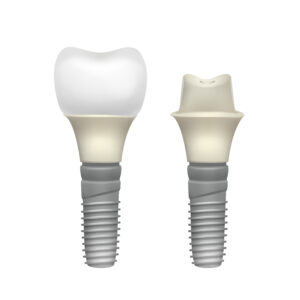 dental implants Yorktown Heights NY