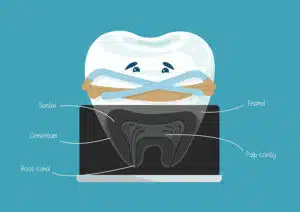 Root Canal Alternatives: Essential Insights for Better Oral Health